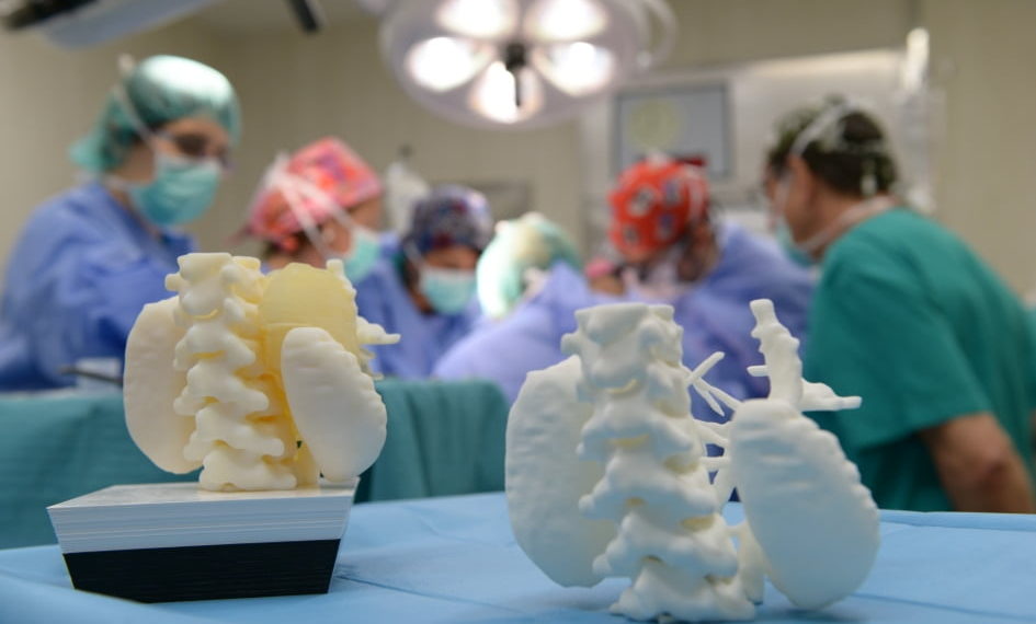 medicos-impresiones-en-3d-para-explicar-enfermedades-medicina