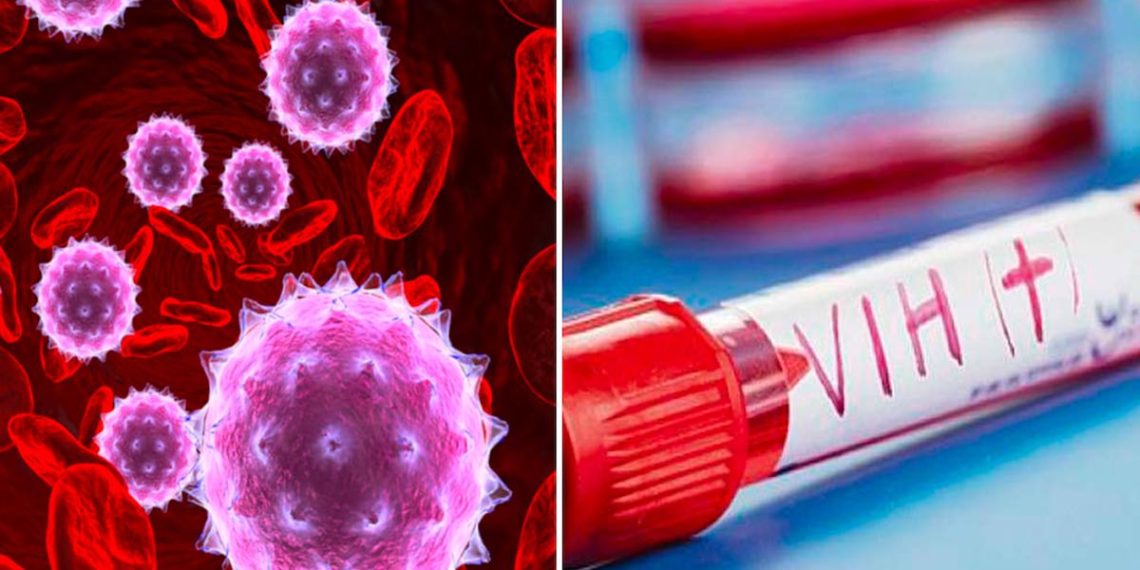 mujer-sida-vih-células-cordón-cura