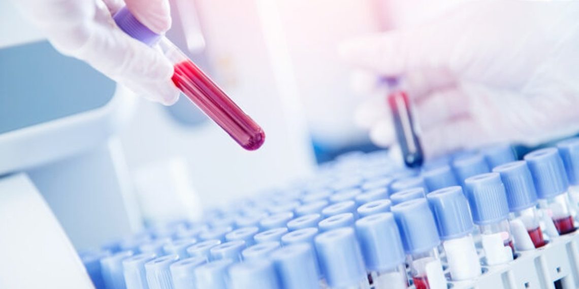 microplasticos-humanos-presencia-sangre-plastico