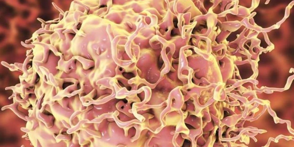 cancer-rectal-dostarlimab-enfermedad