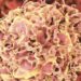 cancer-rectal-dostarlimab-enfermedad