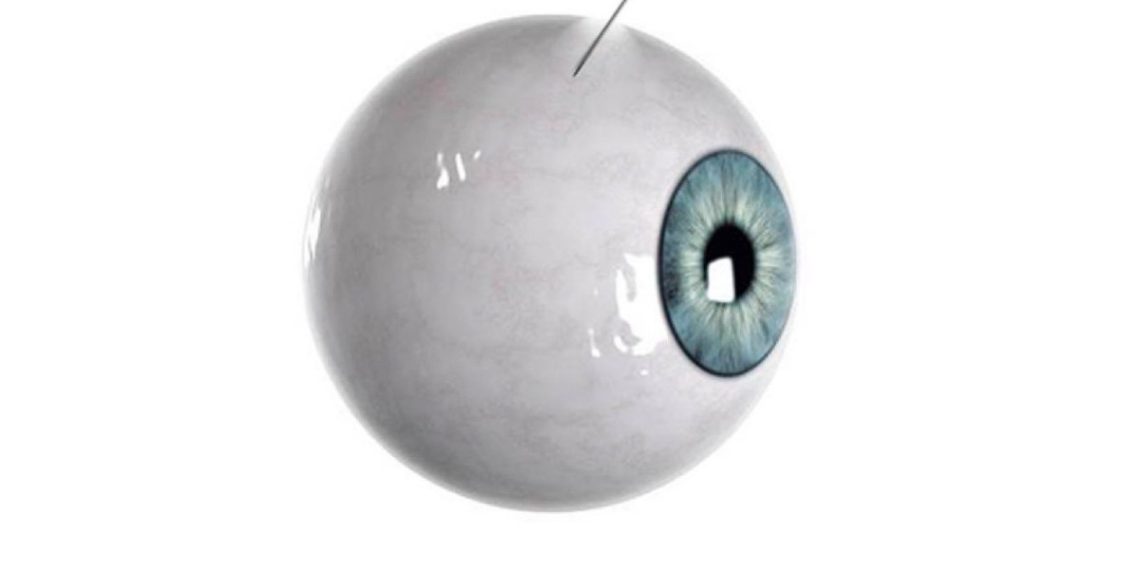 ojos-micro-aguja-inyecciones