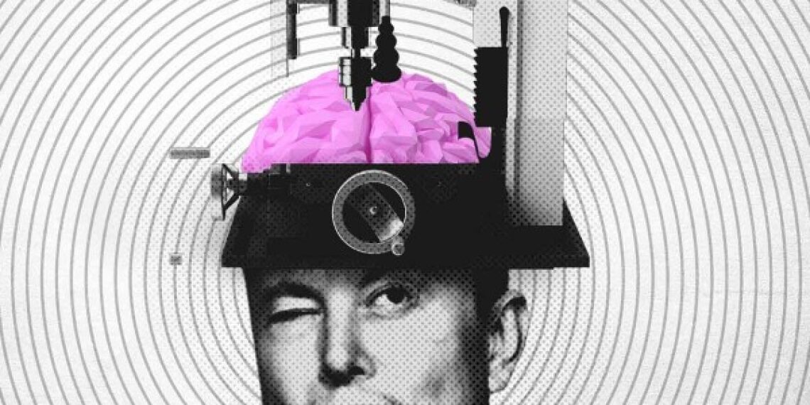 Neuralink: la era de los implantes cerebrales