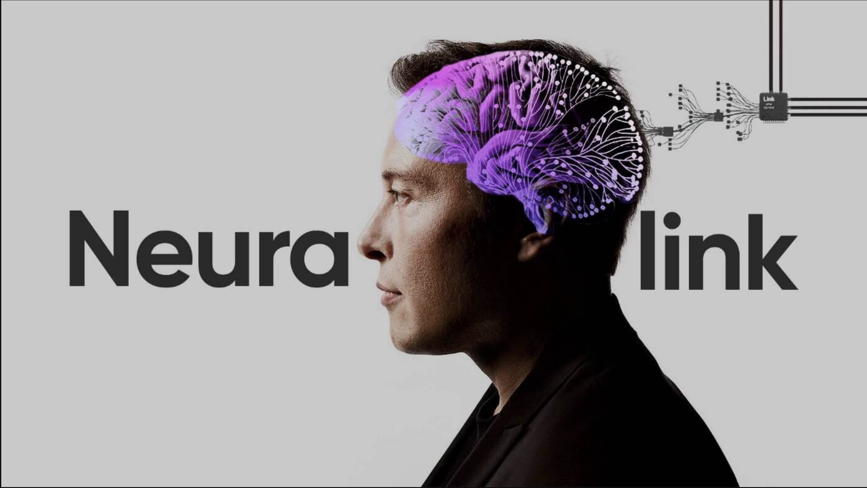 Hombre con Neuralink ya puede controlar mouse con la mente